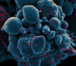 "Colorized scanning electron micrograph of an apoptotic cell (blue) infected with SARS-COV-2 virus particles (red), isolated from a patient sample. Image captured at the NIAID Integrated Research Facility (IRF) in Fort Detrick, Maryland."